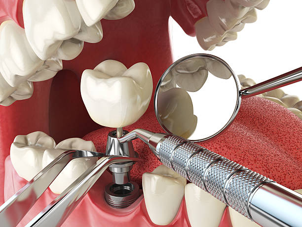 Best Emergency Dental Services for Seniors in Mountain Home, AR